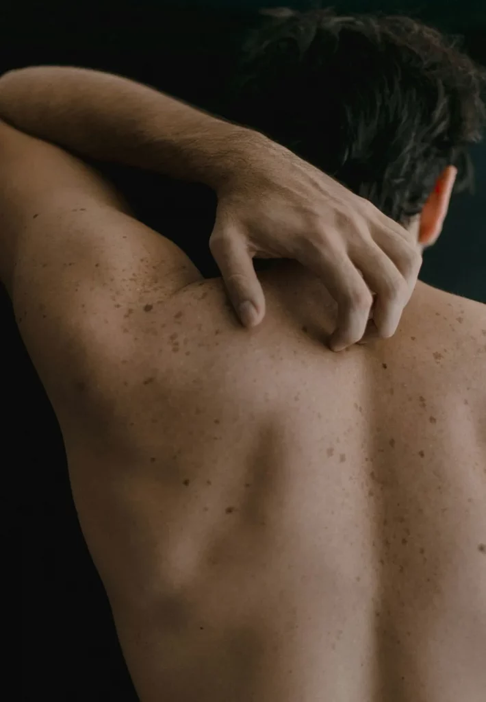 Epilation laser du dos homme